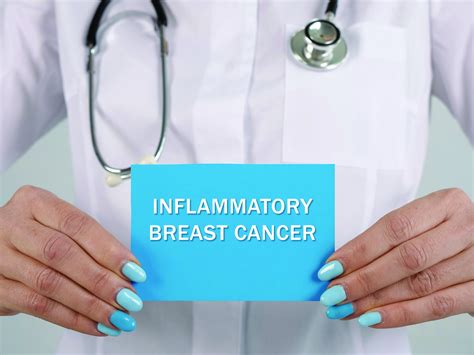 medical concept about inflammatory breast cancer with phrase on the san bernardino american news