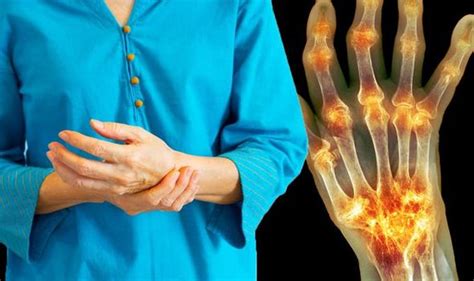 The Subtle Warning Sign Of Rheumatoid Arthritis On Your Fingers That