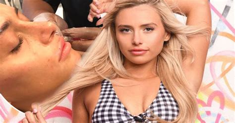 Ellie Brown Plastic Surgery Love Island Contestant S Past Revealed As Doctor Speaks Out On
