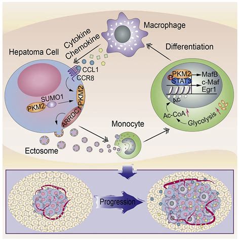Ectosomal Pkm2 Promotes Hcc By Inducing Macrophage Differentiation And