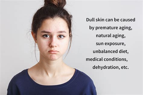 Dull Skin Causes Symptoms Treatment And Complications