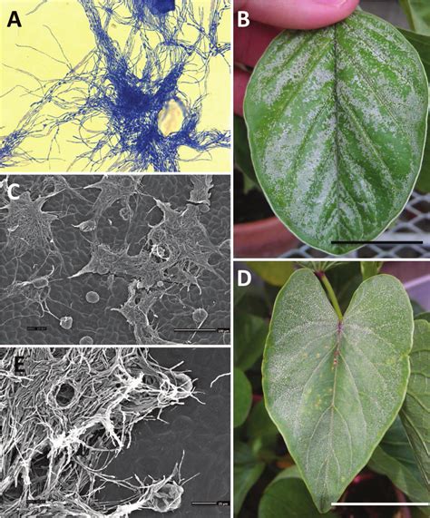 Epiphytic mycelia on adaxial leaf surfaces of morning glories. A. I.... | Download Scientific ...