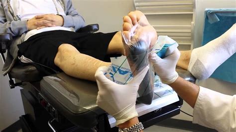 Wound Vac Dressing Change Of A Diabetic Foot Ulcer Nursing Videos