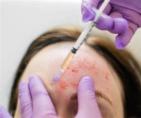 Two People Get Hiv After Beauty Salon Used Dirty Needles For Vampire