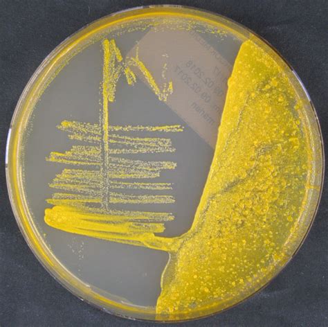 Mycobacterium Scrofulaceum 12238 1356 Tmc1323 Type Strain Dsm
