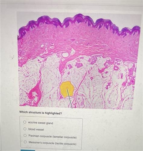 Solved Which Structure Is Highlighted O Eccrine Sweat Gland