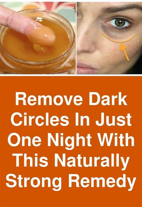 Remove Dark Circles In Just One Night With This Naturally Strong Remedy