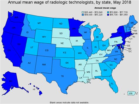 Radiologic Technologist Salaries And Wages By State Radrounds