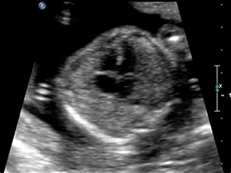 2VSD.FR.INEXT | OB Images