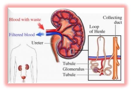 Extension of renal cell carcinoma has implications for prognosis and surgical intervention. Nursing Care Plan for Glomerulonephritis - Nursing Care Plan