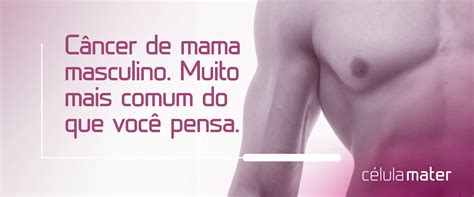 Cancer De Mama Masculino é Fatal