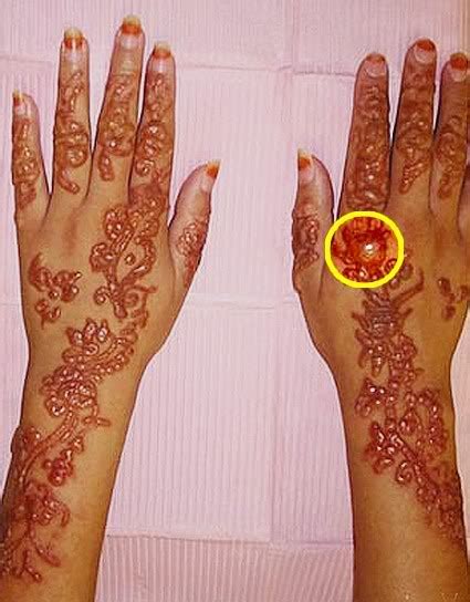 Nor do other possible additives such as vinegar, olive oil, coal and cloves. Henna Tattoots Fail - Page 1 - Rave.ca
