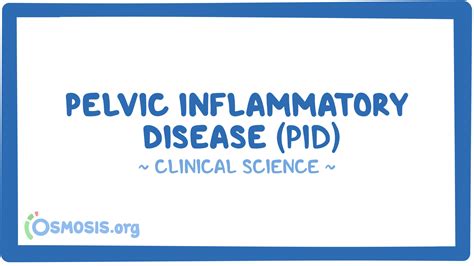 Pelvic Inflammatory Disease Clinical Sciences Osmosis Video Library