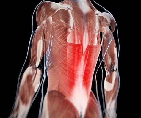 Breaking Down Multifidus Muscle Pain Causes And Symptoms