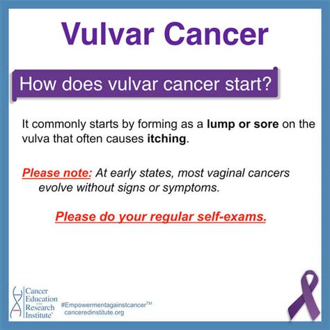 Vulvar Cancer Cancer Education And Research Institute