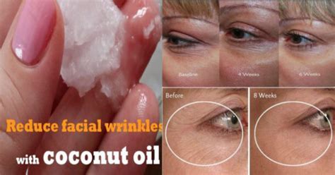 How To Use Coconut Oil For Wrinkles 5 Methods Facial Wrinkles
