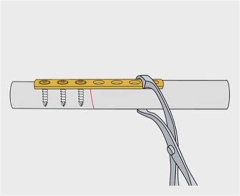 AO Principles of Fracture Management in the Dog and Cat ...
