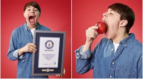 Teen Breaks World Record For The Largest Mouth Gape Navtarang