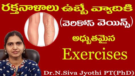 Varicose Veins Home Exercises For Varicose Veins Blue Veins