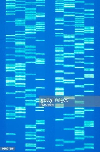 Dna Gel Sequence Photos And Premium High Res Pictures Getty Images