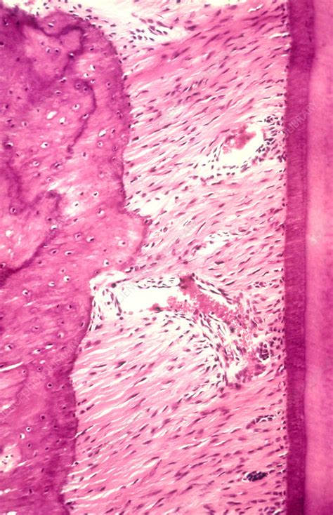 Periodontal Ligament Histology
