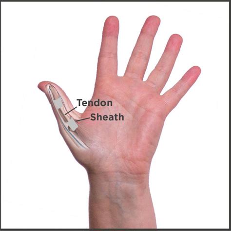 Thumb Tendon Anatomy Anatomical Charts And Posters