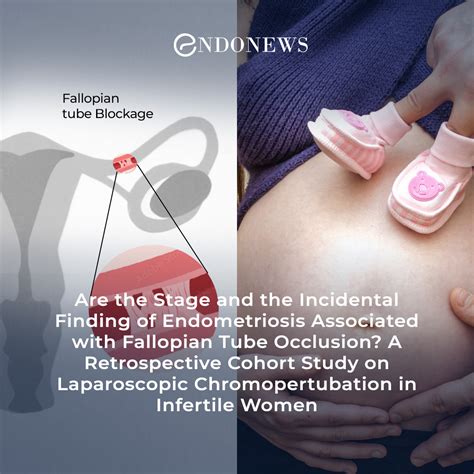 Fallopian Tube Occlusion In Infertile Women With Endometriosis EndoNews