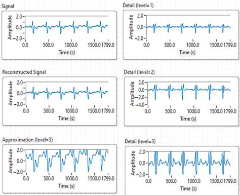 Ecg Signal Analysis Results Using Wavelet Transform And Haar Function