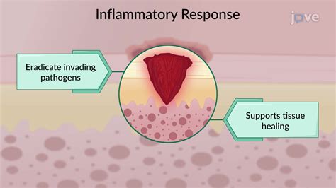 Inflammatory Response Ii Inflammatory Exudate And Tissue Repair