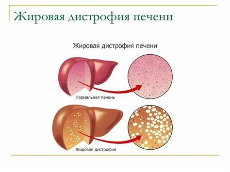 Диета для жировой дистрофии печени Дистрофии как первый реактивный процесс в онтогенезе - презентация онлайн Дистрофии как первый реактивный процесс в онтогенезе - презентация онлайн Диета для жировой дистрофии печени
