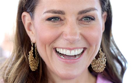 Kate Middleton Teeth What Has Duchess Of Cambridge Done To Her Smile