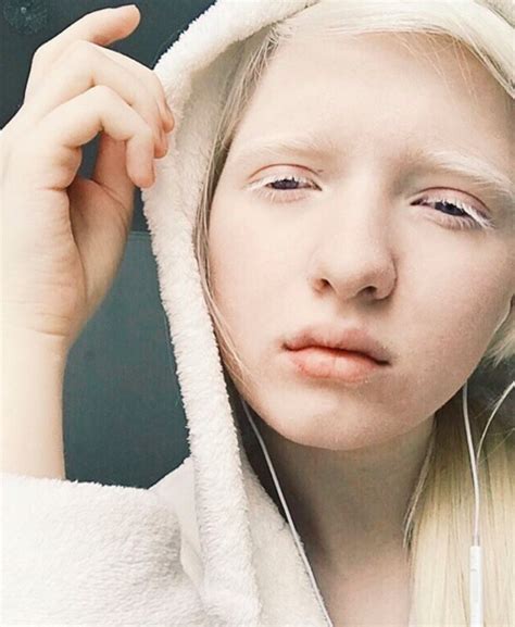Models With Albinism Who Are Taking The Fashion World By Storm Albino Model Albino Girl