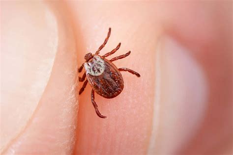 Review other causes of death by clicking the links below or choose the full. Lyme disease may be more common in the UK than we thought ...