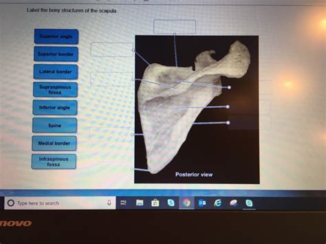 Solved Label The Bony Structures Of The Scapula Superior