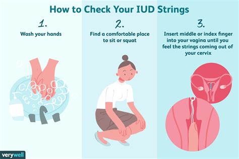 Iud String Color Chart