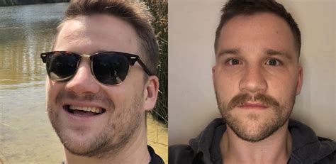 Face Gains After Three Months Of Intermittent Fasting Yes Im Smiling