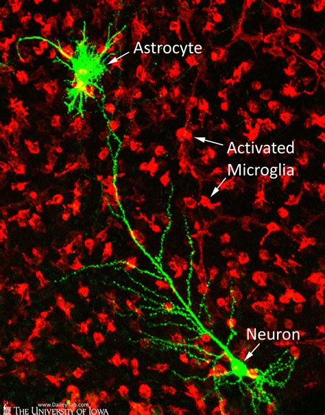 Activated Microglia Astrocyte And Pyramidal Neuron In Rat Hippocampal