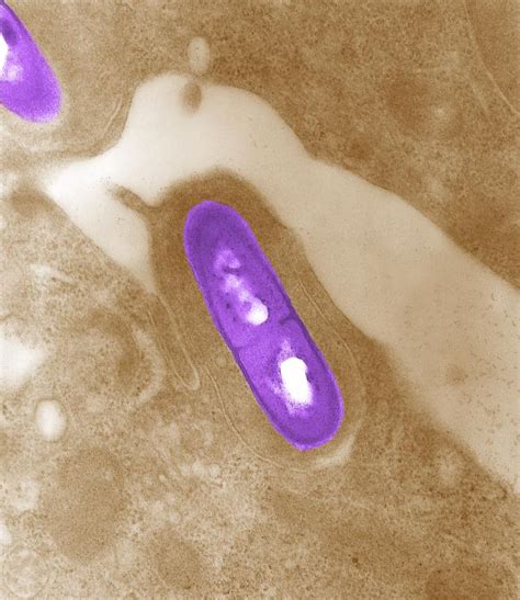 Listeria Monocytogenes Wikidoc