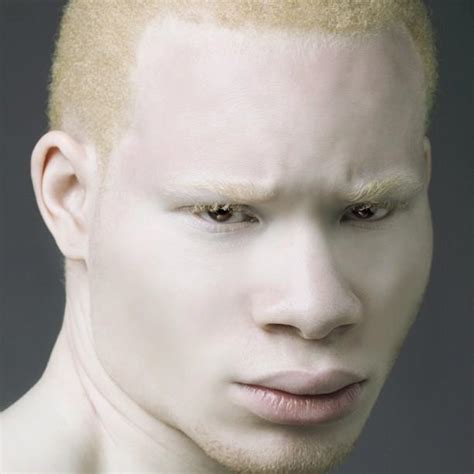 Albinos Culture Nigeria