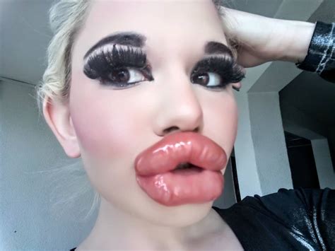 Andrea Ivanova Has The Biggest Lips That Will Make You Look Twice