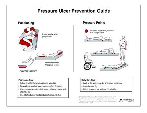Pressure Ulcer Prevention Pressure Ulcer Prevention Guide Pressure My