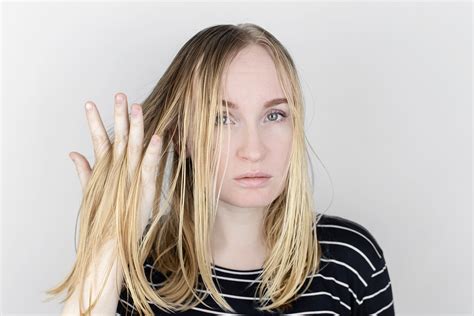 Oily Hair Causes And Solutions Eldorado Hair Restoration