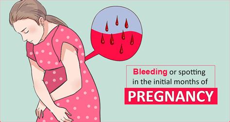 sangramento no primeiro trimestre do período de gravidez conselho médico