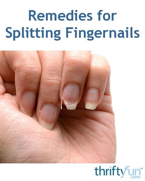 Remedies For Splitting Fingernails Splitting Fingernails Peeling Nails Split Nails