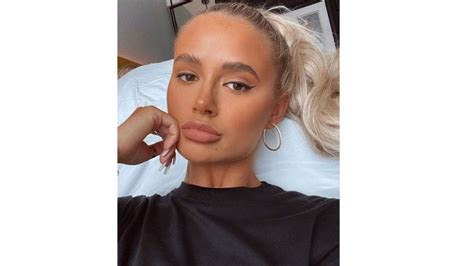 Molly Mae Hague Reveals Shes Undergoing Surgery Following Mole Removal