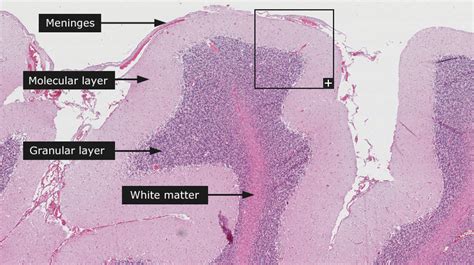 Dictionary Normal Cerebellum The Human Protein Atlas