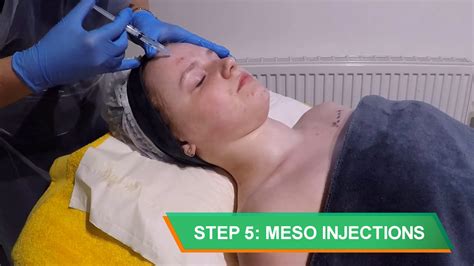 Mesotherapy Facial Treatment 7 Steps Domybeautycouk Youtube