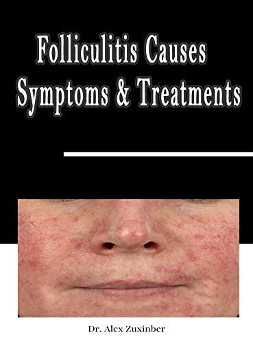 Folliculitis Causes Symptoms And Treatments Bacterial Infection