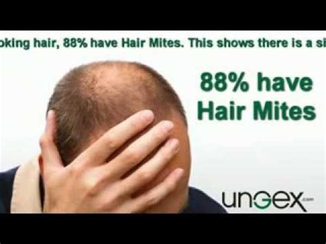 Mites or parasites, there are mites that can be caused scabies, a contagious disease that can be reached to humans. demodex_20m.flv - YouTube
