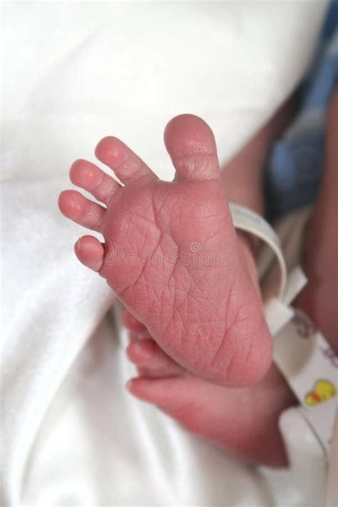 Newborn Feet Peeling Skin Stock Photo Image Of Condition 28123194